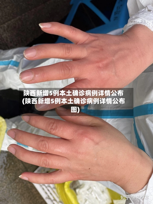 陕西新增5例本土确诊病例详情公布(陕西新增5例本土确诊病例详情公布图)-第2张图片